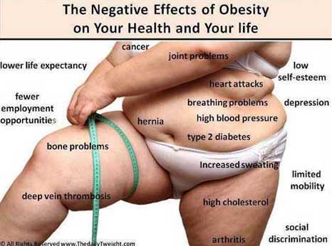 The negative effects of obesity on your health and your life