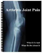 Arthritis Joint Pain